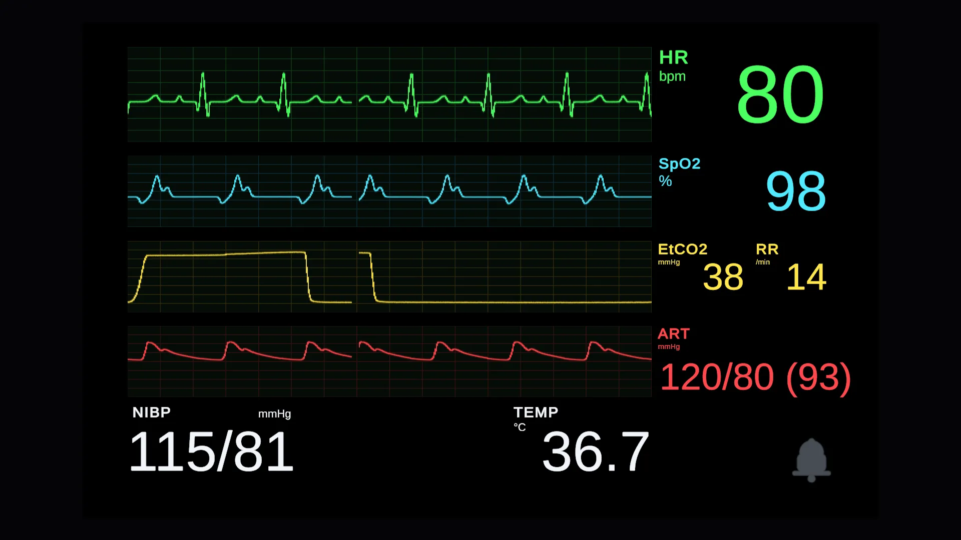 A clinical multi-parameter monitor