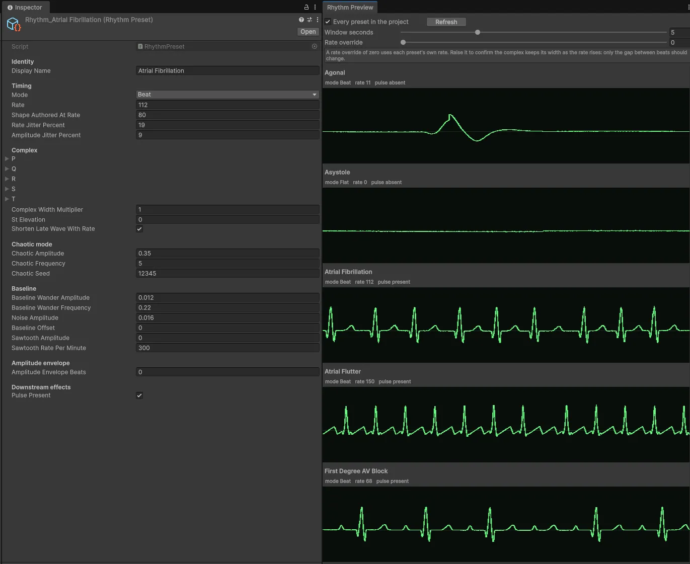 Rhythm presets
